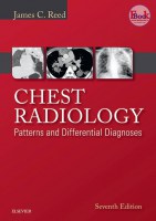 Chest_Radiology_-_Patterns_and_Differential_Diagnoses_7e_www_bookbaz_ir